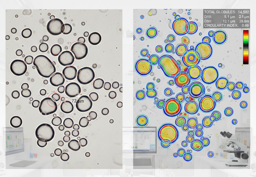 Globule Size Determination in semi-solid dosage forms